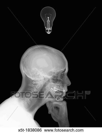 X-ray of a thinking man with a lightbulb View Large Photo Image Stock Photograph - X-ray of a thinking man with a lightbulb. Fotosearch