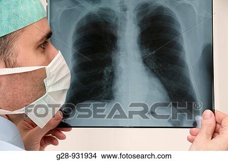 X-ray View Large Photo Image Picture - X-ray. Fotosearch