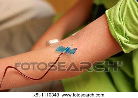Young boy of six having blood drawn from his arm for a bone marrow test Model Release available View Large Photo Image Stock Photo - Young boy of six having blood drawn from his arm for a bone marrow test Model Release available. Fotosearch