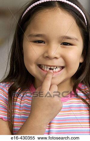 Young girl with tooth missing View Large Photo Image Stock Photography - Young girl with tooth missing. Fotosearch