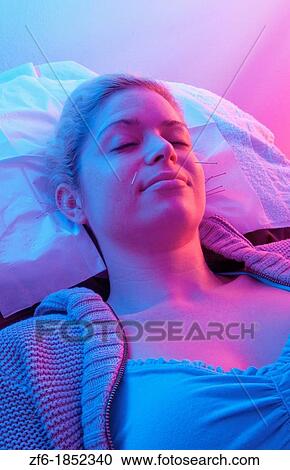 Young woman patient of acupunture getting ear and face needles treatment for pain and allergies View Large Photo Image Stock Image - Young woman patient of acupunture getting ear and face needles treatment for pain and allergies. Fotosearch