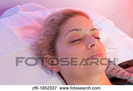 Young woman patient of acupunture getting ear and face needles treatment for pain and allergies View Large Photo Image Stock Photo - Young woman patient of acupunture getting ear and face needles treatment for pain and allergies. Fotosearch