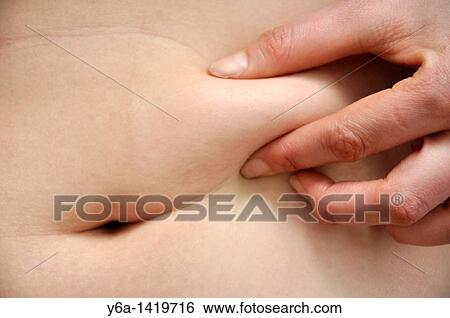 Stock Photograph - Young woman pinching love handles. Fotosearch