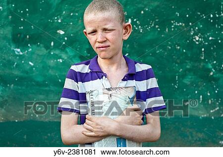 Stock Image - Albino boy holding his school book Ethiopia.. Fotosearch