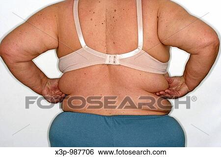 Obese woman View Large Photo Image Stock Photograph - Obese woman. Fotosearch