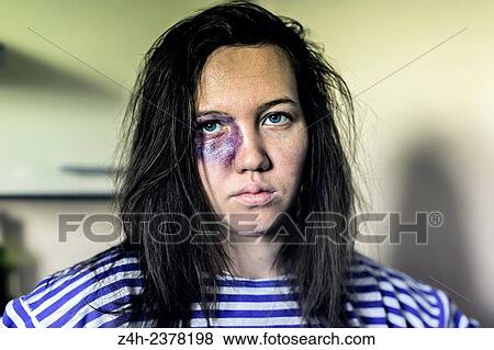 Stock Photo - Young girl drinking alcohol. Alcohol - injury. Love habits.. Fotosearch