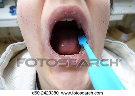 Tooth brushing. Stockholm, Sweden View Large Photo Image Stock Image - Tooth brushing. Stockholm, Sweden. Fotosearch