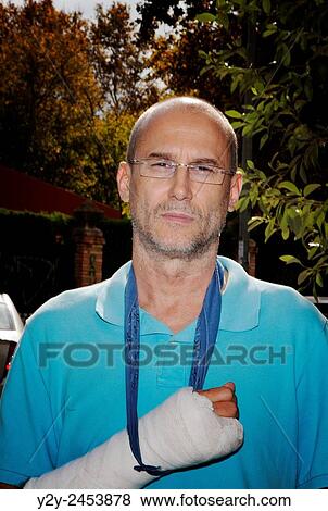 Stock Photo - Broken hand.. Fotosearch