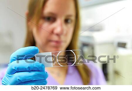 Stock Photo - Cytology, Anatomic Pathology, Hospital Donostia, San Sebastian, Gipuzkoa, Basque Country, Spain. Fotosearch