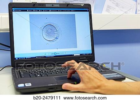 Embryo selection for IVF, URA, ARU, Assisted Reproduction Unit, In Vitro Fertilisation, Intra Cytoplasmic Sperm Injection, Hospital Donostia, San Sebastian, Gipuzkoa, Basque Country, Spain View Large Photo Image Stock Image - Embryo selection for IVF, URA, ARU, Assisted Reproduction Unit, In Vitro Fertilisation, Intra Cytoplasmic Sperm Injection, Hospital Donostia, San Sebastian, Gipuzkoa, Basque Country, Spain. Fotosearch