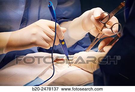 Stock Photo - General surgery, Operating room, Ambulatory Surgery, Hospital Donostia, San Sebastian, Gipuzkoa, Basque Country, Spain. Fotosearch