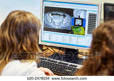 IMRT, Intensity Modulated Radiation Therapy, rectal Cancer 3D Radiotherapy Treatment Planning, Radiotherapy, Hospital Donostia, San Sebastian, Gipuzkoa, Basque Country, Spain View Large Photo Image Picture - IMRT, Intensity Modulated Radiation Therapy, rectal Cancer 3D Radiotherapy Treatment Planning, Radiotherapy, Hospital Donostia, San Sebastian, Gipuzkoa, Basque Country, Spain. Fotosearch