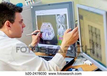 Stock Image - IMRT, Intensity Modulated Radiation Therapy, abdomen Cancer 3D Radiotherapy Treatment Planning, Radiotherapy, Hospital Donostia, San Sebastian, Gipuzkoa, Basque Country, Spain. Fotosearch