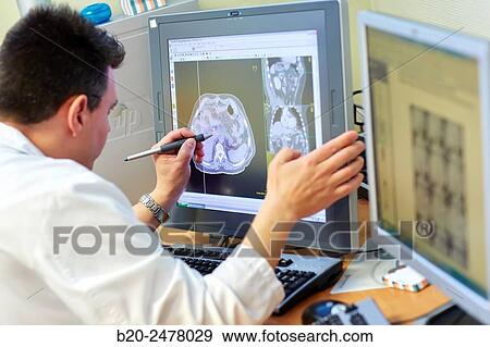 Stock Photo - IMRT, Intensity Modulated Radiation Therapy, abdomen Cancer 3D Radiotherapy Treatment Planning, Radiotherapy, Hospital Donostia, San Sebastian, Gipuzkoa, Basque Country, Spain. Fotosearch