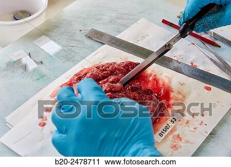 Stock Image - Macros area, Carving, Sample selection of thyroid tissue, Anatomic Pathology, Hospital Donostia, San Sebastian, Gipuzkoa, Basque Country, Spain. Fotosearch
