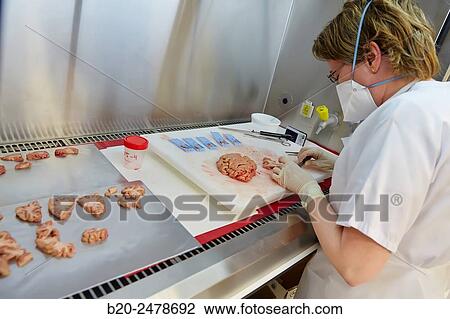 Macros area, Carving, Selecting brain tissue sample, Anatomic Pathology, Hospital Donostia, San Sebastian, Gipuzkoa, Basque Country, Spain View Large Photo Image Stock Image - Macros area, Carving, Selecting brain tissue sample, Anatomic Pathology, Hospital Donostia, San Sebastian, Gipuzkoa, Basque Country, Spain. Fotosearch