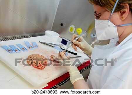 Macros area, Carving, Selecting brain tissue sample, Anatomic Pathology, Hospital Donostia, San Sebastian, Gipuzkoa, Basque Country, Spain View Large Photo Image Stock Image - Macros area, Carving, Selecting brain tissue sample, Anatomic Pathology, Hospital Donostia, San Sebastian, Gipuzkoa, Basque Country, Spain. Fotosearch