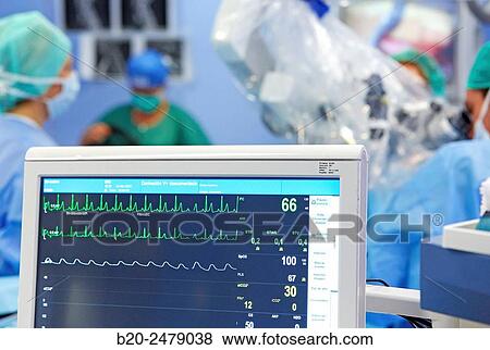 Stock Photo - Operating room, Brain operation, Neurosurgery, Hospital Donostia, San Sebastian, Gipuzkoa, Basque Country, Spain. Fotosearch