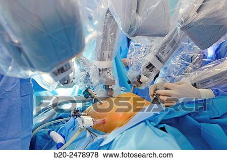 Stock Photo - Operating room, Prostate cancer robotic surgery, Da Vinci surgical robot, Urology, Hospital Donostia, San Sebastian, Gipuzkoa, Basque Country, Spain. Fotosearch