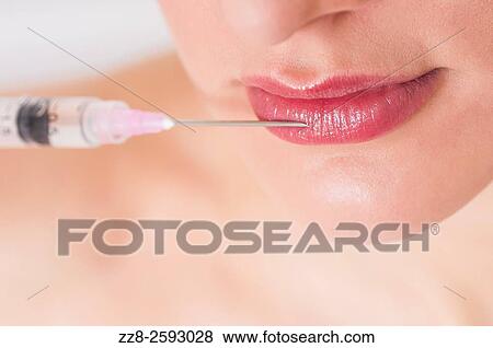 Close up of a young woman receiving a botox injection to her lips. View Large Photo Image Stock Photo - Close up of a young woman receiving a botox injection to her lips.. Fotosearch
