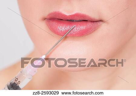 Close up of a young woman receiving a botox injection to her lips. View Large Photo Image Stock Photo - Close up of a young woman receiving a botox injection to her lips.. Fotosearch