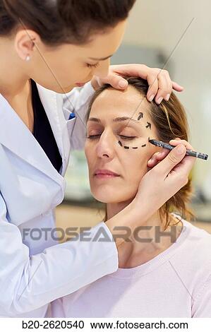 Facelift. Blepharoplasty. Rhytidoplasty. It involves stretching the facial skin in order to remove wrinkles. Before surgery it is necessary to mark the facial aesthetic units and choose the voltage vectors that apply in the intervention. Plastic surgery. View Large Photo Image Stock Image - Facelift. Blepharoplasty. Rhytidoplasty. It involves stretching the facial skin in order to remove wrinkles. Before surgery it is necessary to mark the facial aesthetic units and choose the voltage vectors that apply in the intervention. Plastic surgery. . Fotosearch