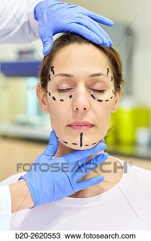 Facelift. Blepharoplasty. Rhytidoplasty. It involves stretching the facial skin in order to remove wrinkles. Before surgery it is necessary to mark the facial aesthetic units and choose the voltage vectors that apply in the intervention. Plastic surgery. View Large Photo Image Stock Image - Facelift. Blepharoplasty. Rhytidoplasty. It involves stretching the facial skin in order to remove wrinkles. Before surgery it is necessary to mark the facial aesthetic units and choose the voltage vectors that apply in the intervention. Plastic surgery. . Fotosearch