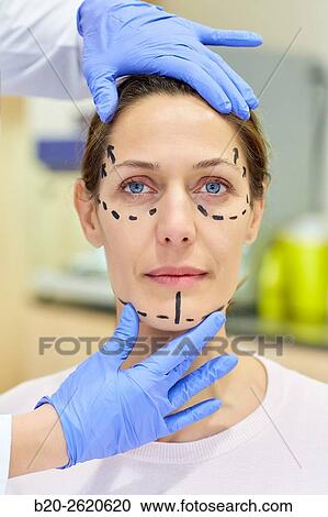 Stock Image - Facelift. Blepharoplasty. Rhytidoplasty. It involves stretching the facial skin in order to remove wrinkles. Before surgery it is necessary to mark the facial aesthetic units and choose the voltage vectors that apply in the intervention. Plastic surgery. . Fotosearch