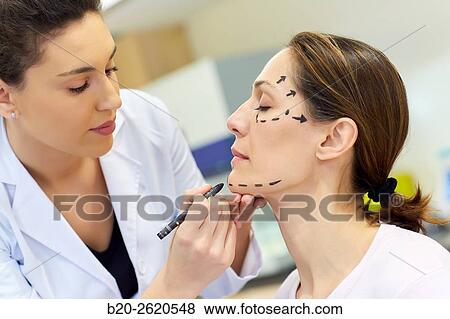 Stock Photo - Facelift. Blepharoplasty. Rhytidoplasty. It involves stretching the facial skin in order to remove wrinkles. Before surgery it is necessary to mark the facial aesthetic units and choose the voltage vectors that apply in the intervention. Plastic surgery. . Fotosearch