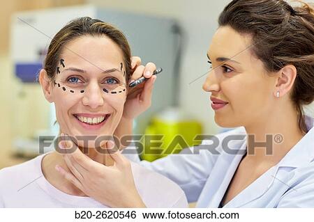 Stock Photograph - Facelift. Blepharoplasty. Rhytidoplasty. It involves stretching the facial skin in order to remove wrinkles. Before surgery it is necessary to mark the facial aesthetic units and choose the voltage vectors that apply in the intervention. Plastic surgery. . Fotosearch