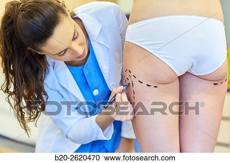 Liposuction. Liposculpture. It consists of aspiration cannulae of body fat deposits established. Before surgery a cartographic mapping of these deposits are made. Plastic surgery. Doctor attending to patient medical consultation. View Large Photo Image Stock Image - Liposuction. Liposculpture. It consists of aspiration cannulae of body fat deposits established. Before surgery a cartographic mapping of these deposits are made. Plastic surgery. Doctor attending to patient medical consultation.. Fotosearch