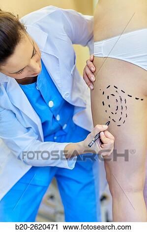 Liposuction. Liposculpture. It consists of aspiration cannulae of body fat deposits established. Before surgery a cartographic mapping of these deposits are made. Plastic surgery. Doctor attending to patient medical consultation. View Large Photo Image Stock Image - Liposuction. Liposculpture. It consists of aspiration cannulae of body fat deposits established. Before surgery a cartographic mapping of these deposits are made. Plastic surgery. Doctor attending to patient medical consultation.. Fotosearch