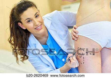 Stock Photo - Liposuction. Liposculpture. It consists of aspiration cannulae of body fat deposits established. Before surgery a cartographic mapping of these deposits are made. Plastic surgery. Doctor attending to patient medical consultation.. Fotosearch