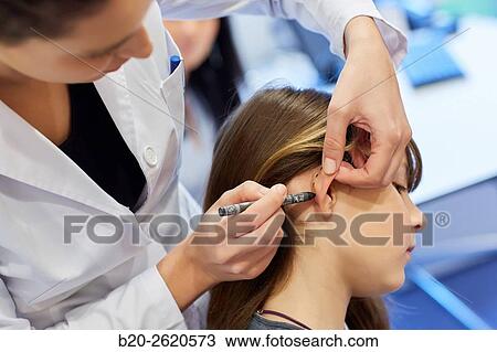 Otoplasty. winged ears. Malformation there is an absence antehelix crease. Otoplasty involves molding the ear cartilage to create a new fold. Doctor attending to patient medical consultation. Office. Plastic surgery. Pediatrician. View Large Photo Image Stock Image - Otoplasty. winged ears. Malformation there is an absence antehelix crease. Otoplasty involves molding the ear cartilage to create a new fold. Doctor attending to patient medical consultation. Office. Plastic surgery. Pediatrician.. Fotosearch