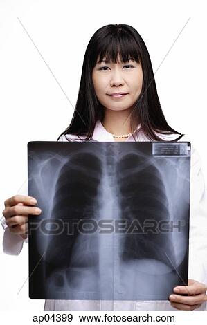 Doctor holding X-ray, looking at camera View Large Photo Image Stock Photo - Doctor holding X-ray, looking at camera. Fotosearch
