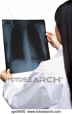 Stock Image - Doctor looking at X-ray, rear view. Fotosearch