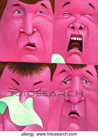 Allergy View Large Illustration Stock Illustration - Allergy. Fotosearch