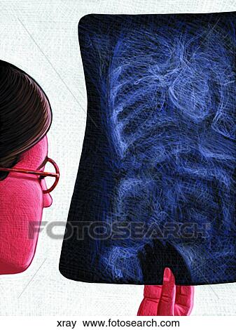 X-ray View Large Illustration Stock Illustration - X-ray. Fotosearch