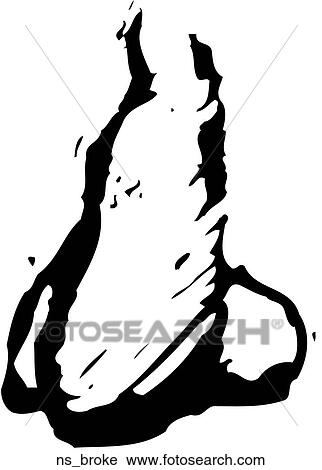 Broken Nose View Large Clip Art Graphic Clipart - Broken Nose. Fotosearch
