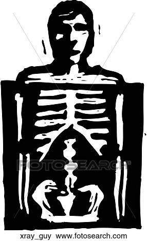 X-Ray Guy View Large Clip Art Graphic Clip Art - X-Ray Guy. Fotosearch