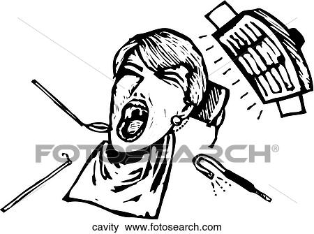 Cavity View Large Clip Art Graphic Clip Art - Cavity. Fotosearch