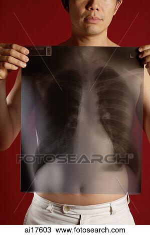Stock Image - Man holding X-ray over chest . Fotosearch