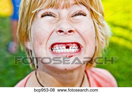 boy showing off missing tooth View Large Photo Image Stock Photo - boy showing off missing tooth. Fotosearch