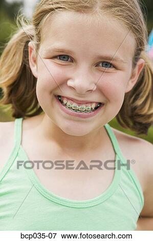 微笑の女の子 身に着けていること Orthodontic 歯列矯正ブレース 写真館 イメージ館 p035 07 Fotosearch