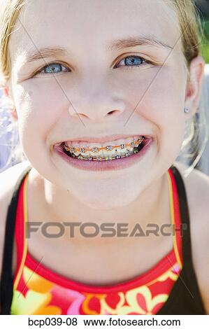Girl showing off her braces View Large Photo Image Stock Photo - Girl showing off her braces. Fotosearch
