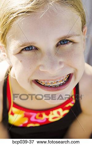 Stock Photo - Young girl showing off her braces. Fotosearch