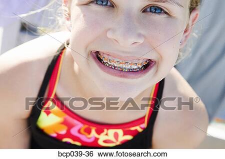 Young girl showing off her braces View Large Photo Image Stock Photograph - Young girl showing off her braces. Fotosearch