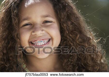 Close up of African girl with braces smiling View Large Photo Image Stock Image - Close up of African girl with braces smiling . Fotosearch