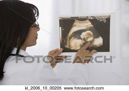 Female doctor looking at sonogram View Large Photo Image Stock Photography - Female doctor looking at sonogram. Fotosearch