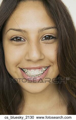 Stock Image - Hispanic girl wearing braces. Fotosearch